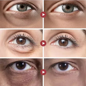 Rolon 5 em 1 Ultra Rejuvenescedor Luteína Inova® PAGUE 1 LEVE 4 (ENVIO NACIONAL)