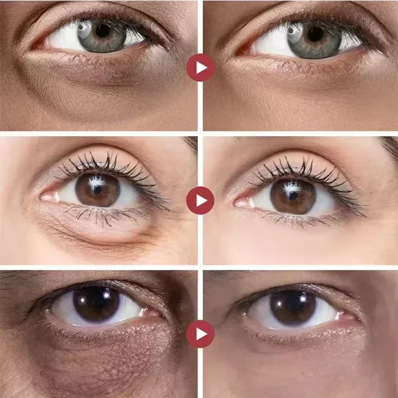 Rolon 5 em 1 Ultra Rejuvenescedor Luteína Inova® PAGUE 1 LEVE 4 (ENVIO NACIONAL)